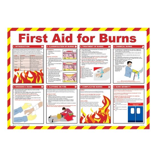 First aid for burns Poster, 840 x 590mm, Laminated - from Tiger Supplies Ltd - 550-03-86