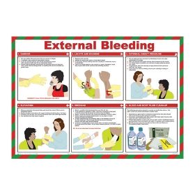 External bleeding Poster, 590 x 420mm, Laminated - from Tiger Supplies Ltd - 550-03-78